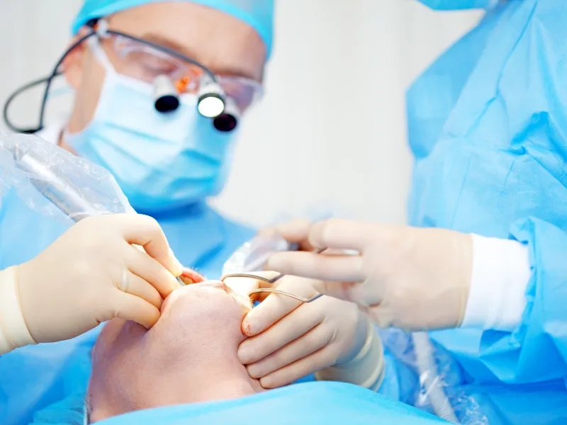 عملية خلع الاسنان بالجراحة