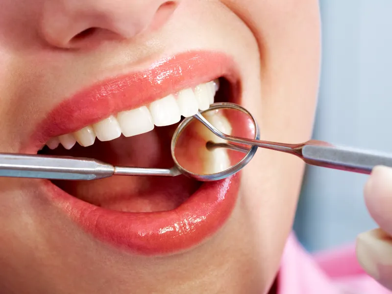 انواع تركيبات الاسنان الزيركون